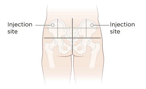 testosterone-injection-site-image